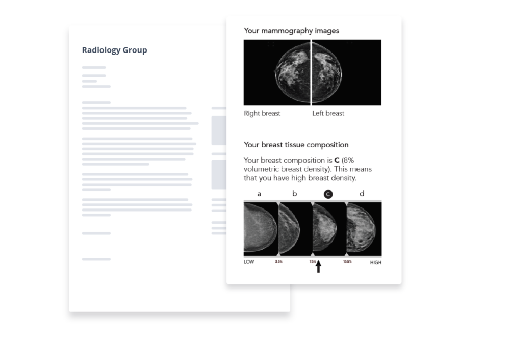 Patient Letter with mammogram images and TruDensity scale