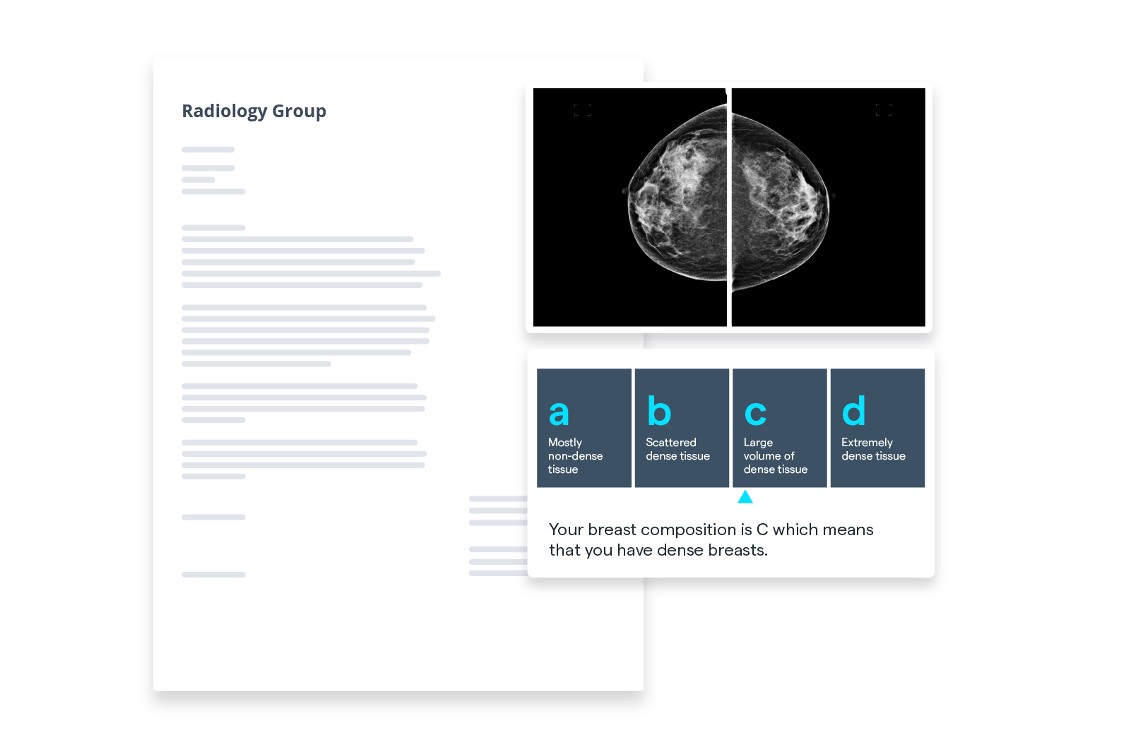 Patient results letter with breast denisty information