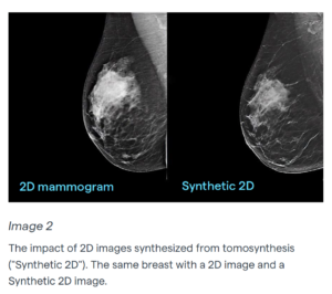 2D/3D Mammography, Density Assessment Software